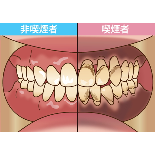 歯医者　東海市　予防歯科